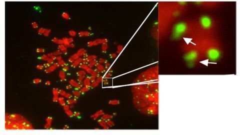 What Controls the Tips of Our Chromosomes?