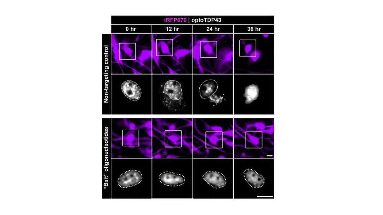 Researchers "Bait" Proteins Behind Neurodegeneration