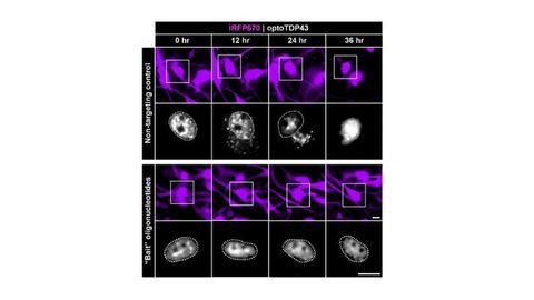 Researchers "Bait" Proteins Behind Neurodegeneration