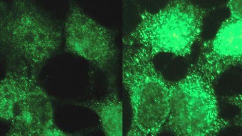Tool Reveals Molecular Causes of Disease Including Infant Cancer
