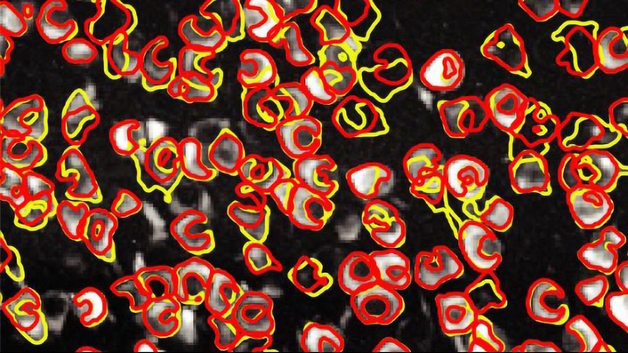 Open-Source Software Tracks Neural Activity in Real Time