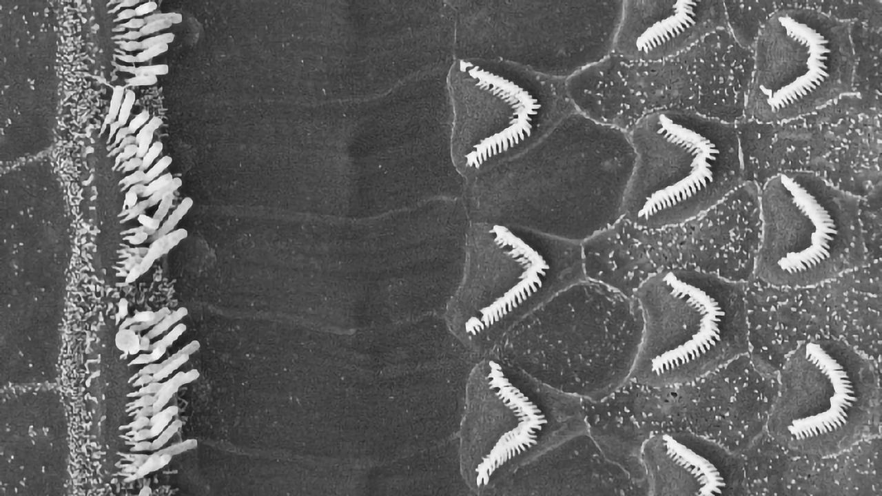 Protein Spring Helps Our Brain Recognize Sound