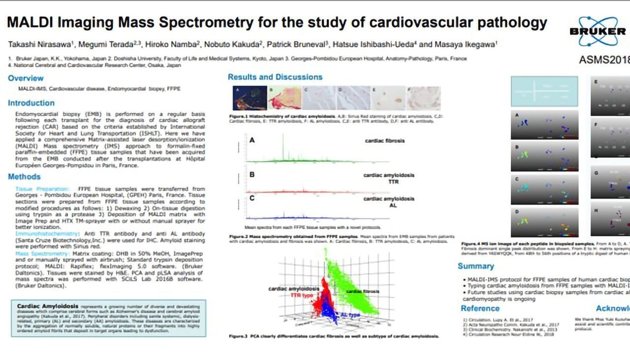 MALDI Imaging Mass Spectrometry for the Study of Cardiovascular Pathology