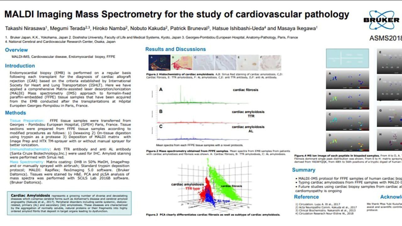 MALDI成像质谱法用于研究心血管病理学