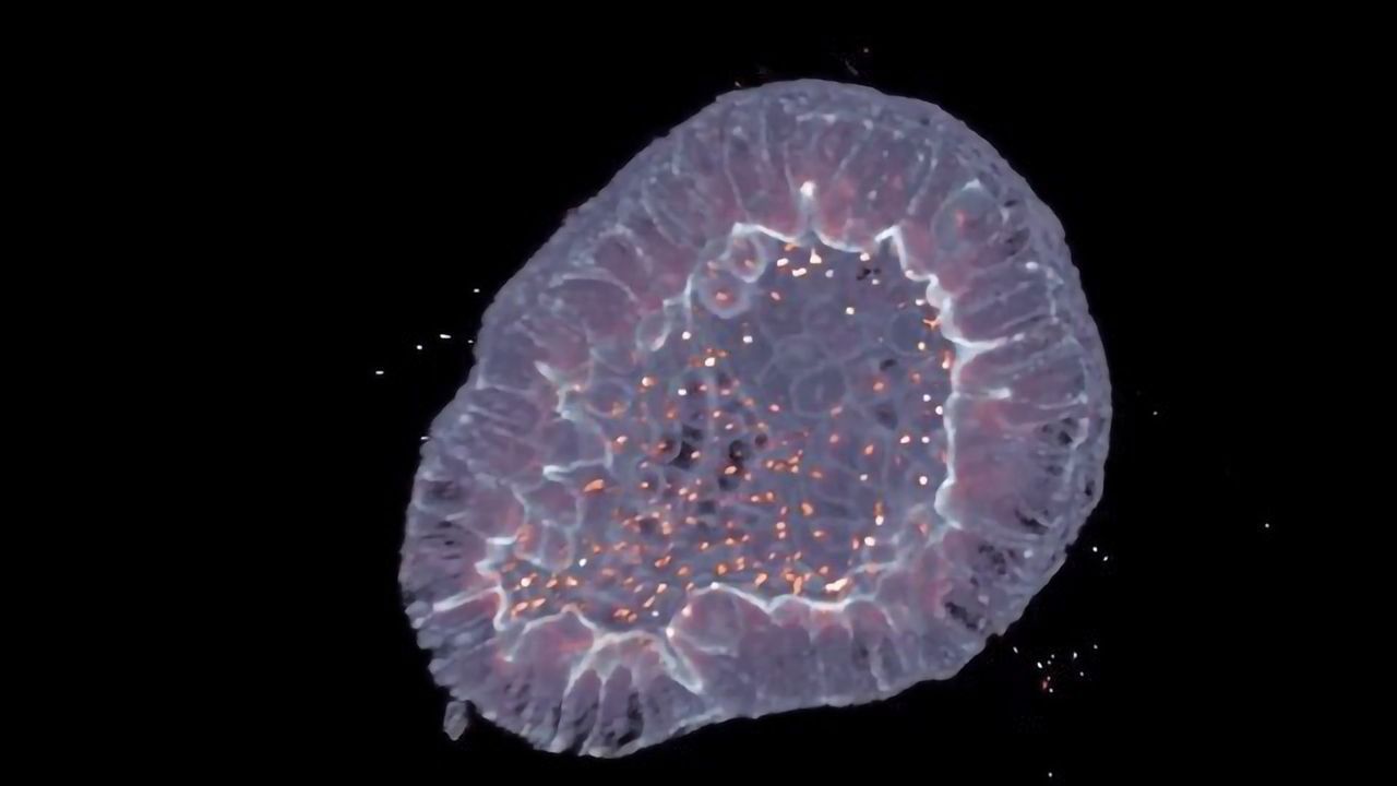 Urine-derived Kidney Organoids Enable Assessment of Cystic Fibrosis Treatment