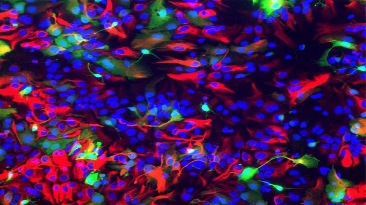 Genetic "Conductor" of Brain Stem Cells