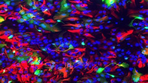 Genetic "Conductor" of Brain Stem Cells