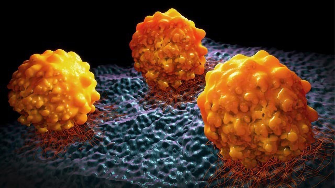 Therapeutic Approach for Pancreatic Cancer Moves Forward
