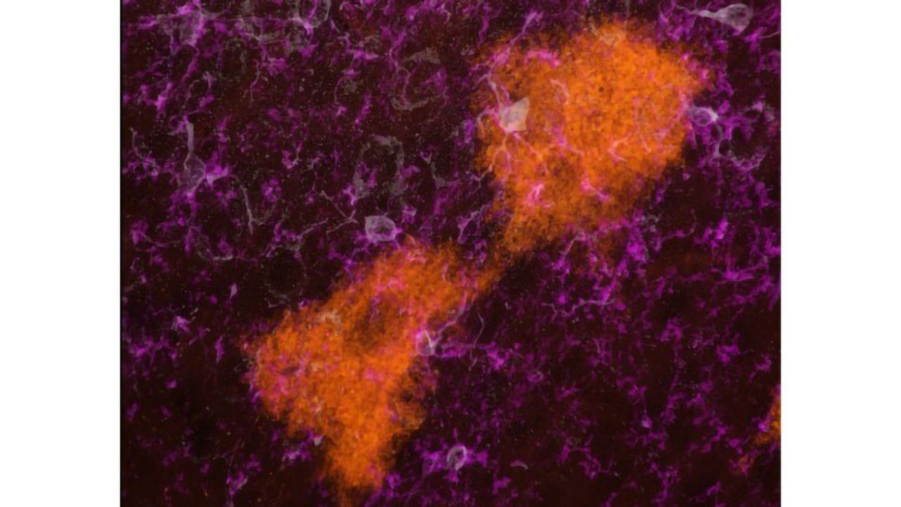 TIGER Mouse Visualizes Vesicles