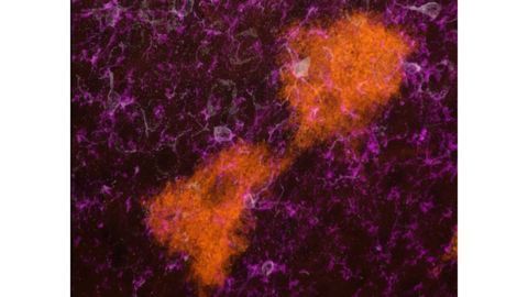TIGER Mouse Visualizes Vesicles