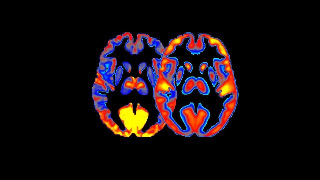 Exploring How Alcohol Affects Energy Use in the Brain