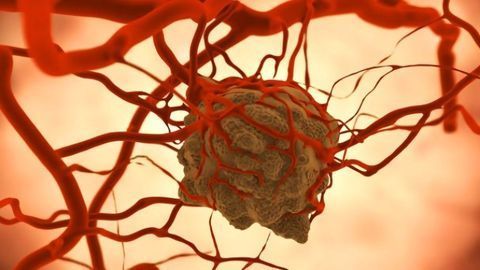 Theranostics: Therapy Plus Diagnostics Targets Specific Tumors