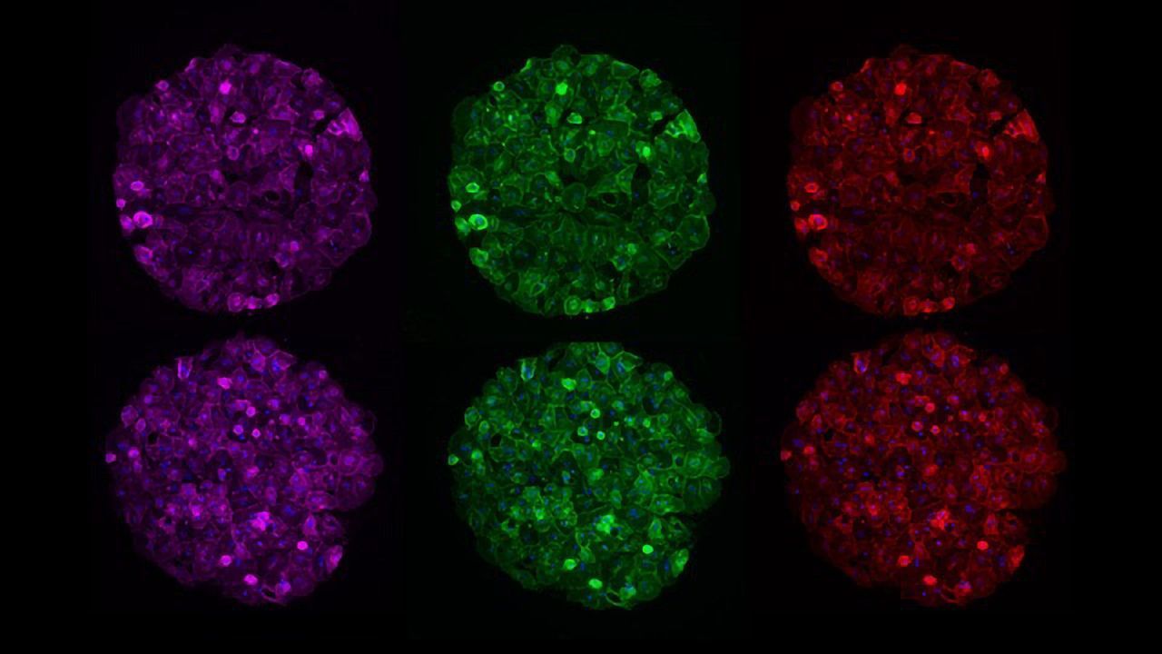 Engineered Liver Model Allows Testing of New Therapy Classes