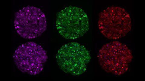Engineered Liver Model Allows Testing of New Therapy Classes