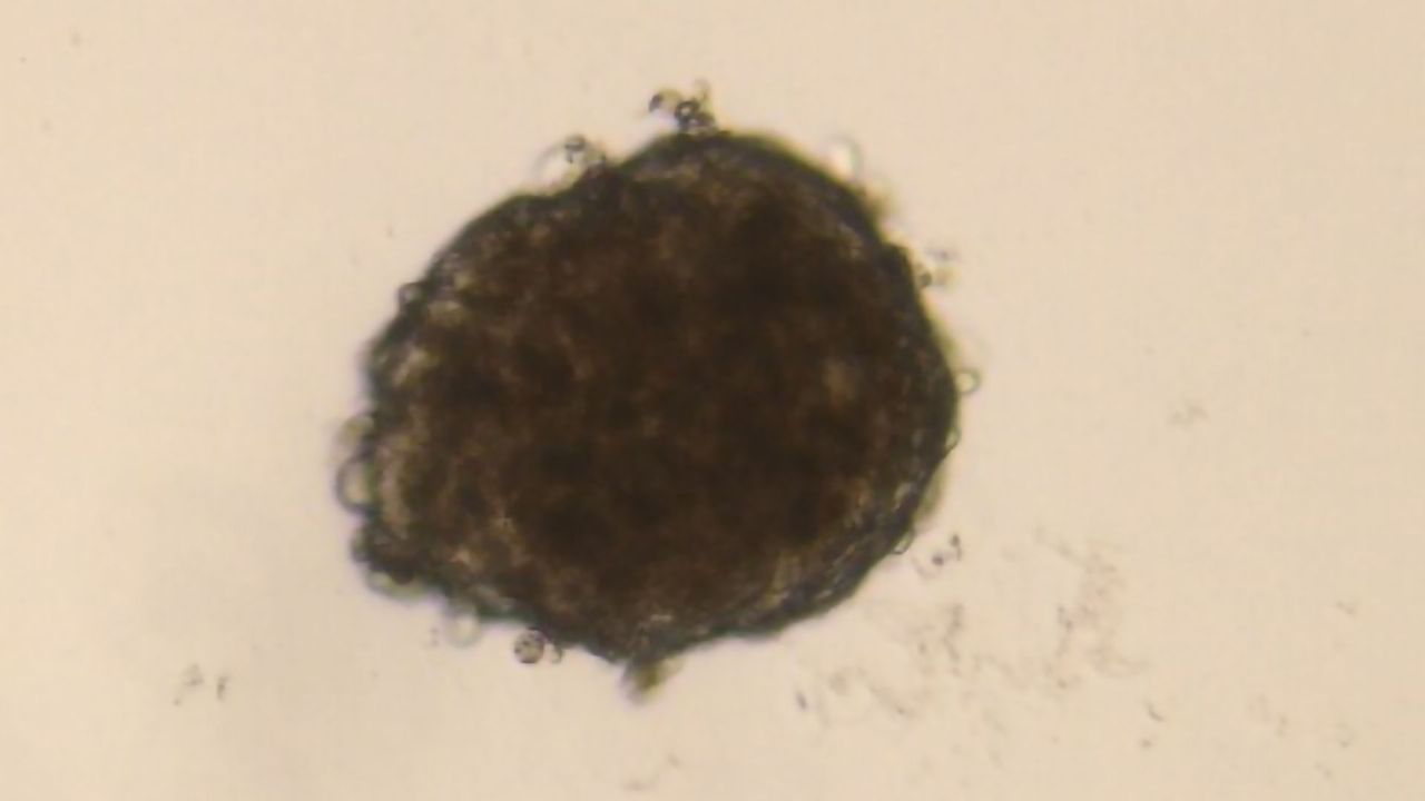 Lonza’s New Spheroid-Forming Human Hepatocytes Facilitate Improved In Vitro Liver Model Systems