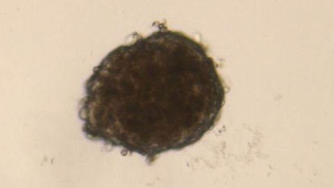 Lonza’s New Spheroid-Forming Human Hepatocytes Facilitate Improved In Vitro Liver Model Systems