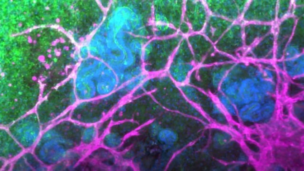 Kidney Organoids: Flow-Enhanced Vascularization and Maturation In Vitro