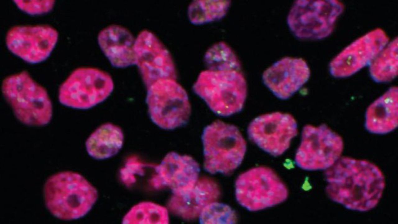 A New Avenue for Infertility Research