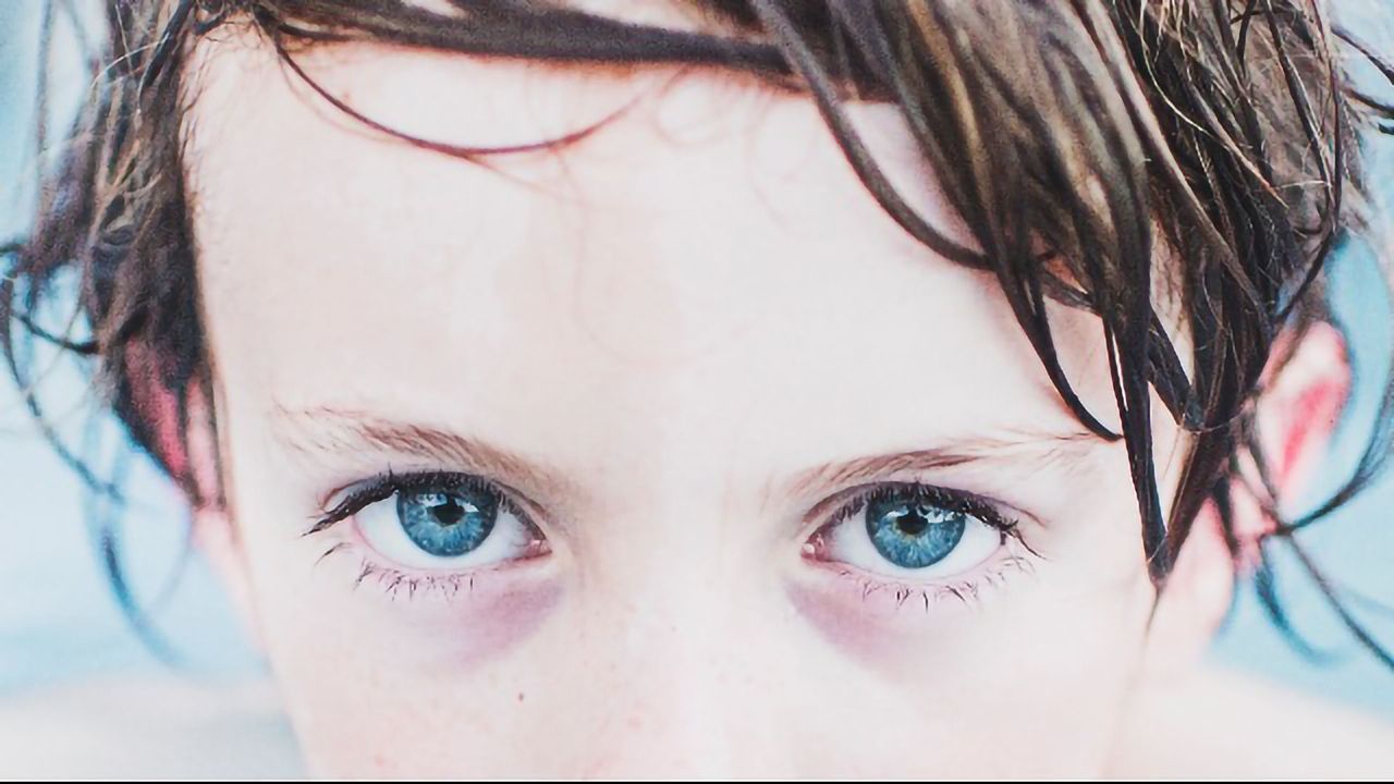 Using AI to Screen for Fetal Alcohol Spectrum Disorder