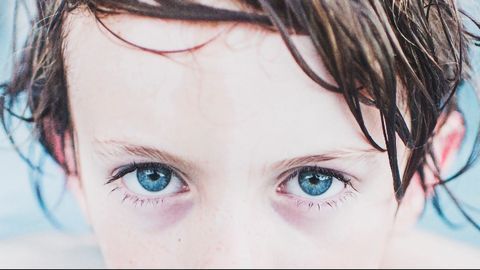 Using AI to Screen for Fetal Alcohol Spectrum Disorder