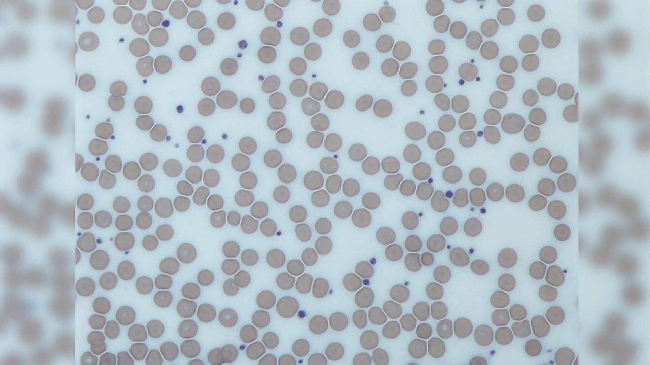 Coagulation-dependent Fibrinogen Deposits in Liver Drive Regeneration