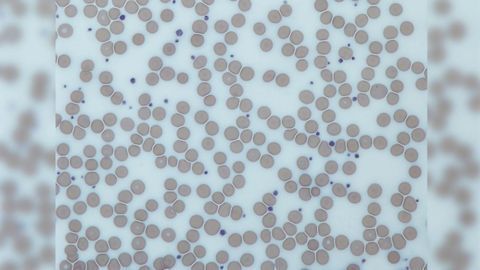 Coagulation-dependent Fibrinogen Deposits in Liver Drive Regeneration