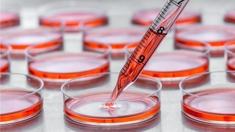 Rapid Cell Detachment from Tissue Culture Plasticware