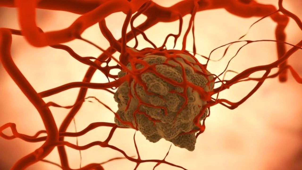 Detecting Differences Between Radiation-Sensitive and Resistant Tumors