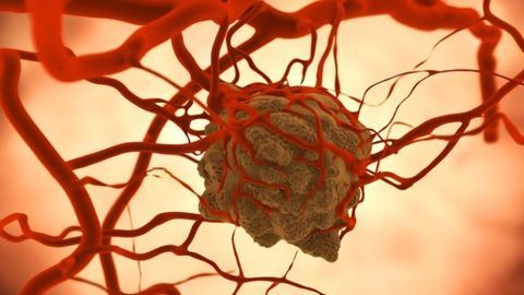 Detecting Differences Between Radiation-Sensitive and Resistant Tumors