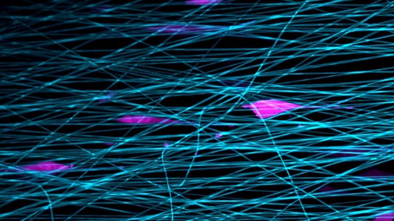 Cells Slingshot Themselves Forward