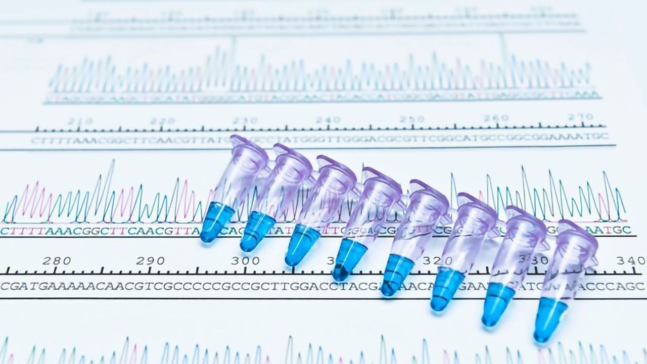 Troubleshooting in PCR – The Essential Checklist