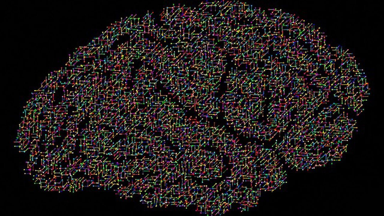 Neurodevelopmental Disorder Modeled in Stem Cell-derived Brain Organoids