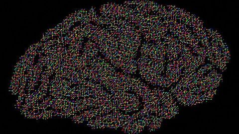 Neurodevelopmental Disorder Modeled in Stem Cell-derived Brain Organoids