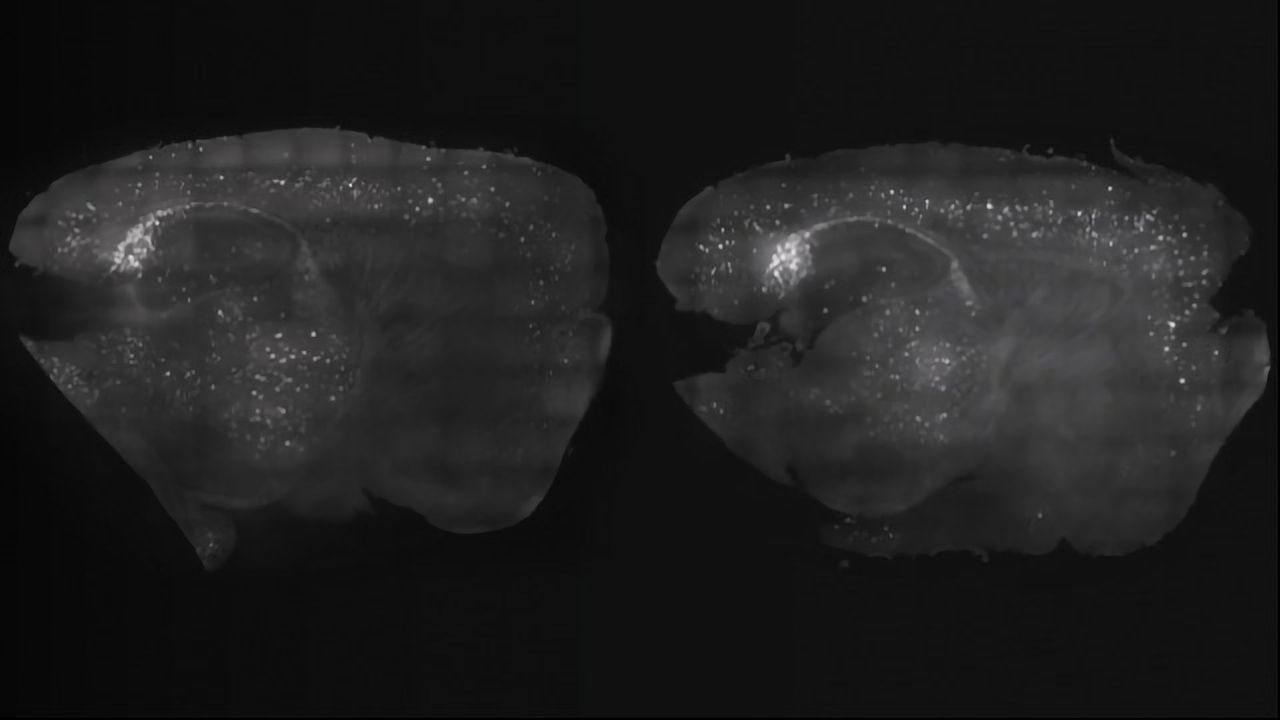 Brain Wave Stimulation Reduces Amyloid Levels, Finds Mouse Study