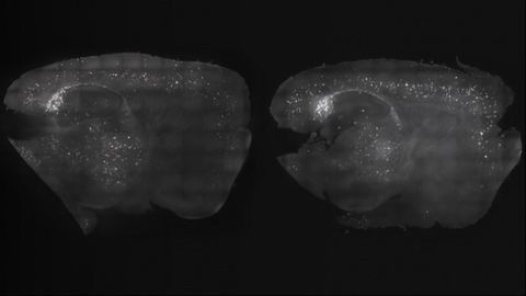 Brain Wave Stimulation Reduces Amyloid Levels, Finds Mouse Study