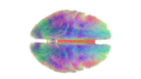 The Role of a Deep Brain Structure in Concussion