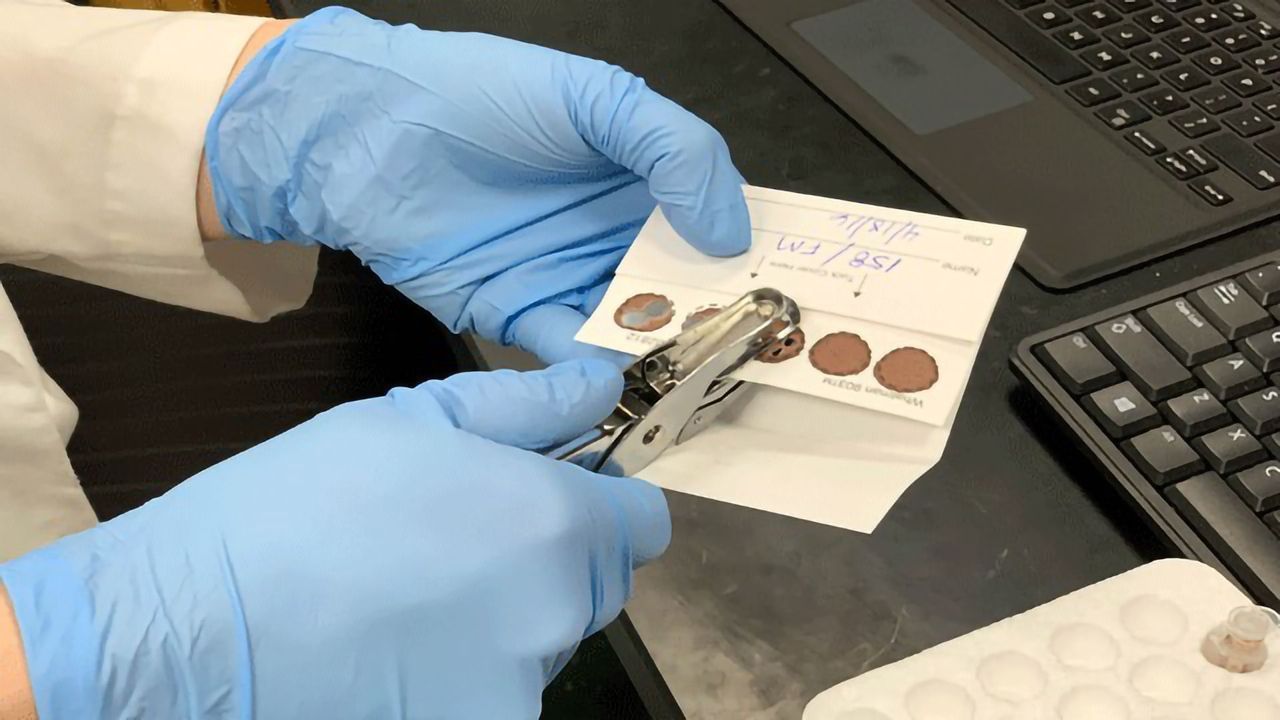 Blood Test Distinguishes Fibromyalgia From Other Inflammatory Conditions
