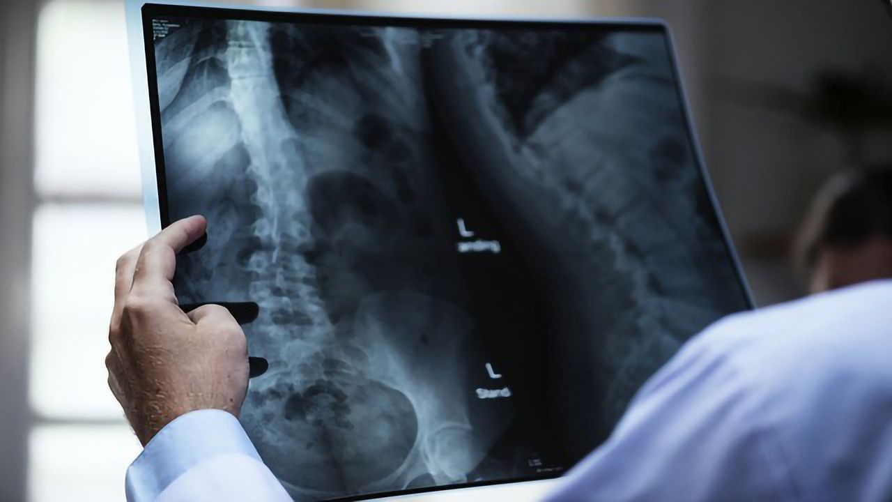 Gene Medication to Treat Spinal Cord Injury