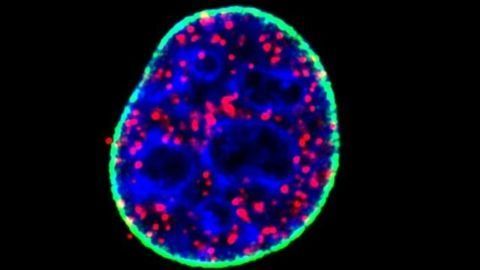 The Key to a Common Cancer Pathway