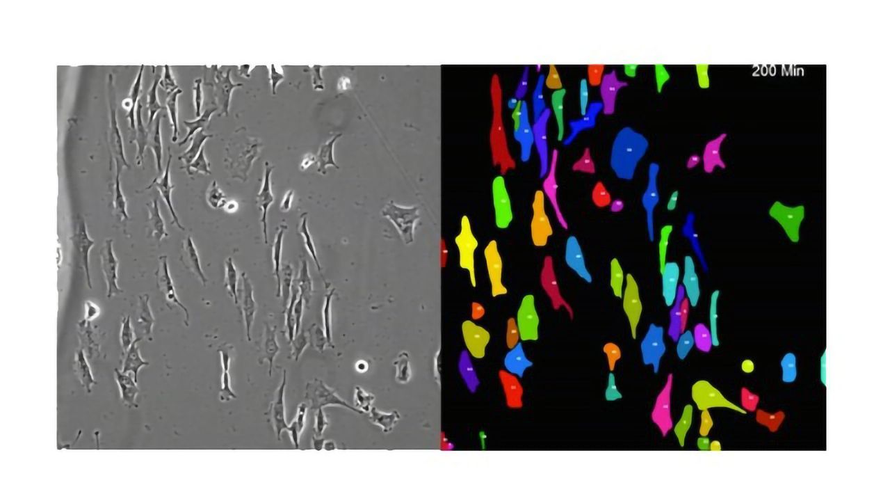 Machine Learning Tracks Moving Cells