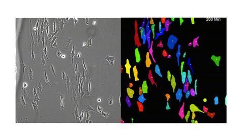Machine Learning Tracks Moving Cells