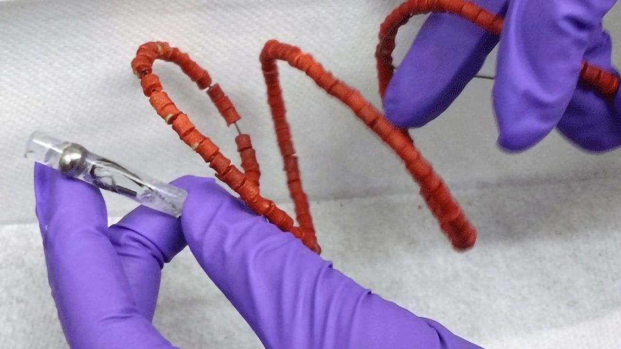 Device Would Allow TB Dosing to Switch From Daily to Monthly