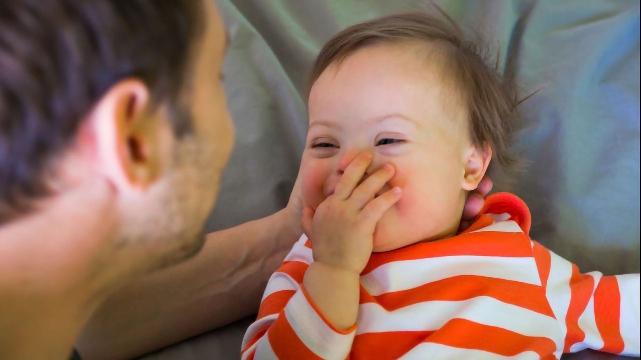 World Down Syndrome Day 2019: An Interview With Down Syndrome Expert Dr Julia Kinder