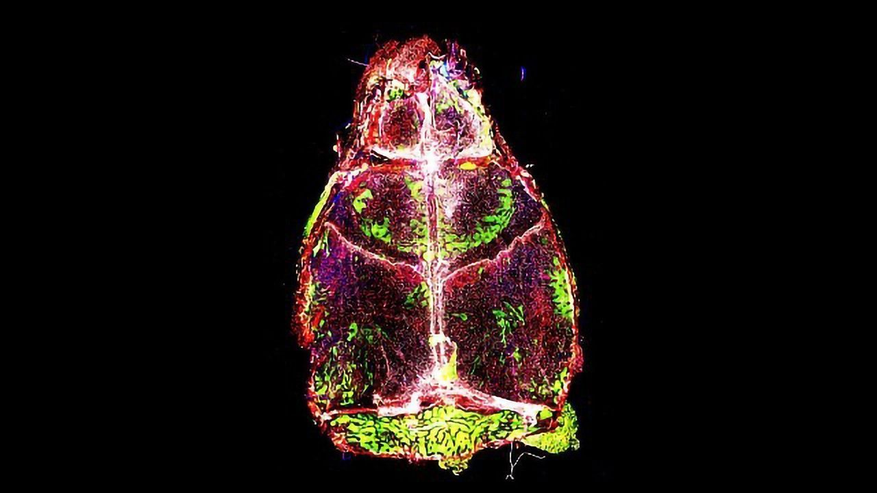 Meningitis Changes Immune Cell Makeup in the Mouse Brain Lining