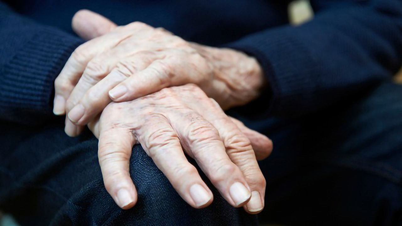 Antiepileptics Increase Pneumonia Risk in Those With Alzheimer’s