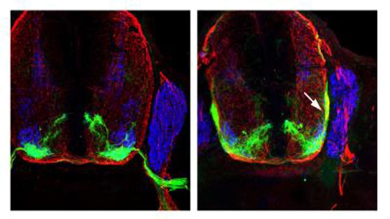 Like Mountaineers, Nerves Need Expert Guidance to Find Their Way