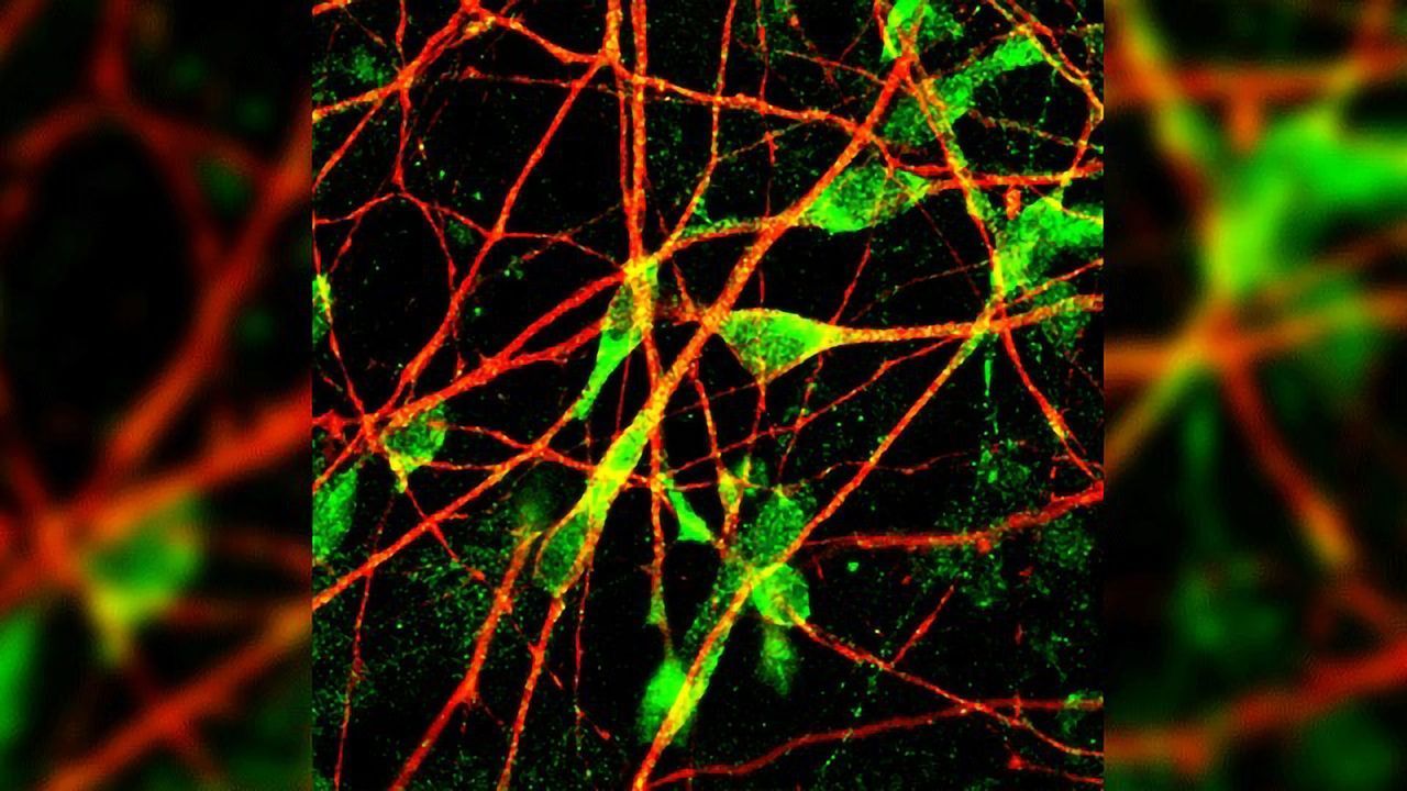 Antidepressant Response May Vary With Individual Differences in Neuron Morphology