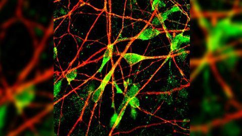 Antidepressant Response May Vary With Individual Differences in Neuron Morphology