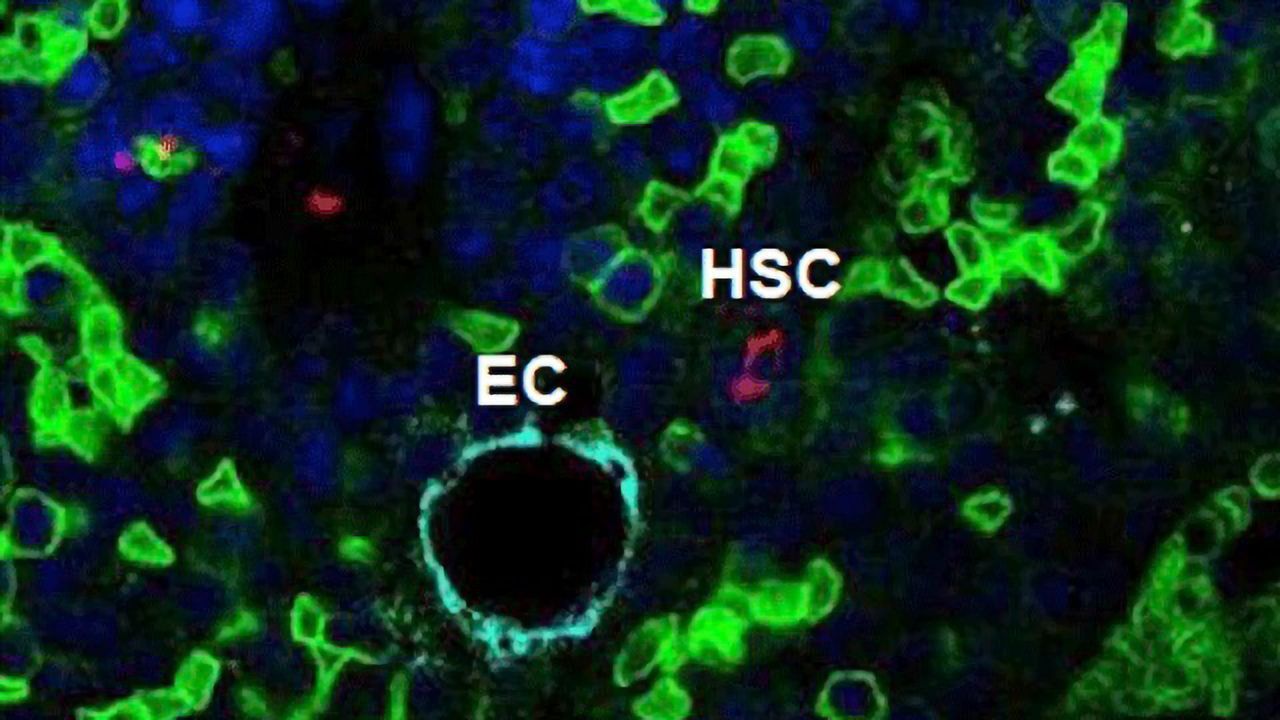 Squishing Blood Stem Cells Could Facilitate Harvest for Transplants