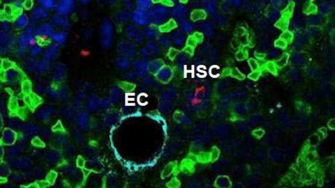 Squishing Blood Stem Cells Could Facilitate Harvest for Transplants